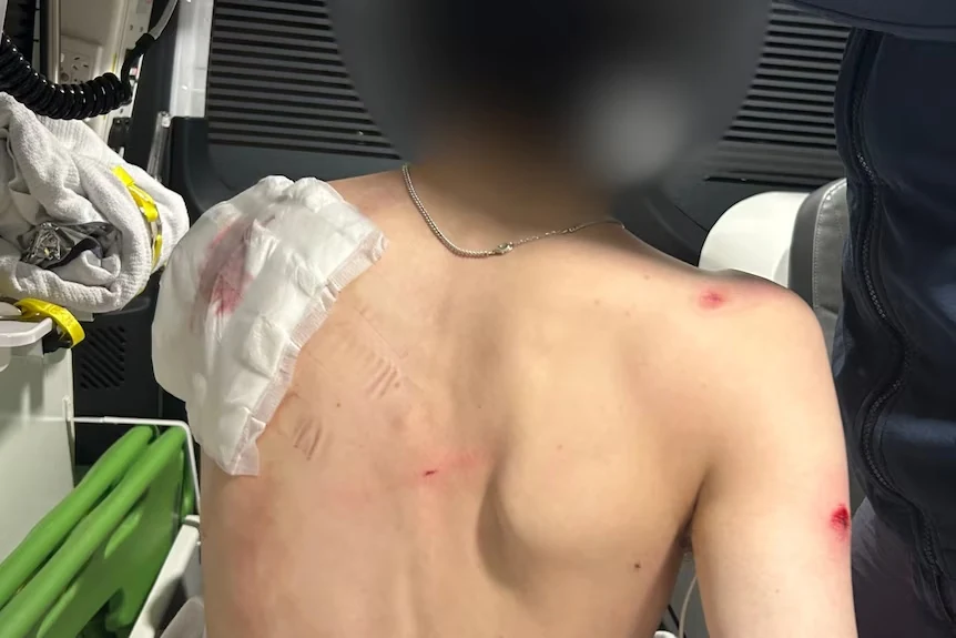 Ambulans içinde omuz bölgesi bandajlanmış, yüzü bulanıklaştırılmış genç.
