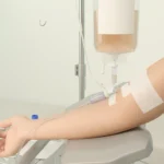 Damardan demir tedavisini temsil eden klinik serum düzeneği; temsili.
